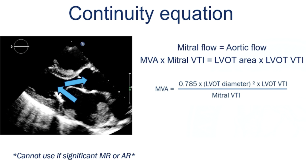 Continuity equation for mitral stenosis (MS)